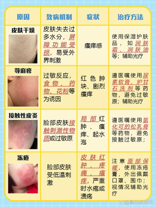 皮肤炎症的诱因有哪些？