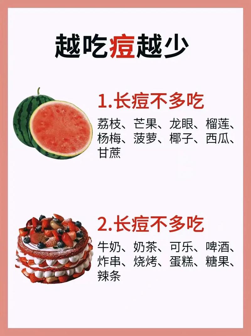 长痘后哪些食物该忌口？
