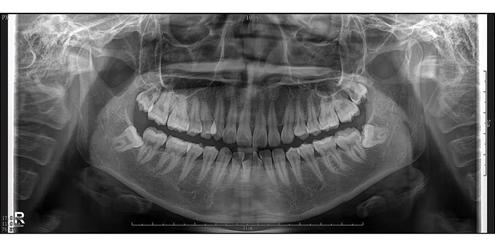 北大口腔梁成纠纷究竟是怎么回事?