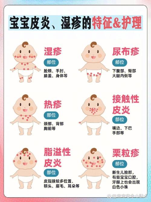 儿童皮肤病图片种类有哪些？