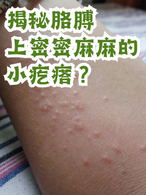 皮肤干燥起小疙瘩是过敏吗?