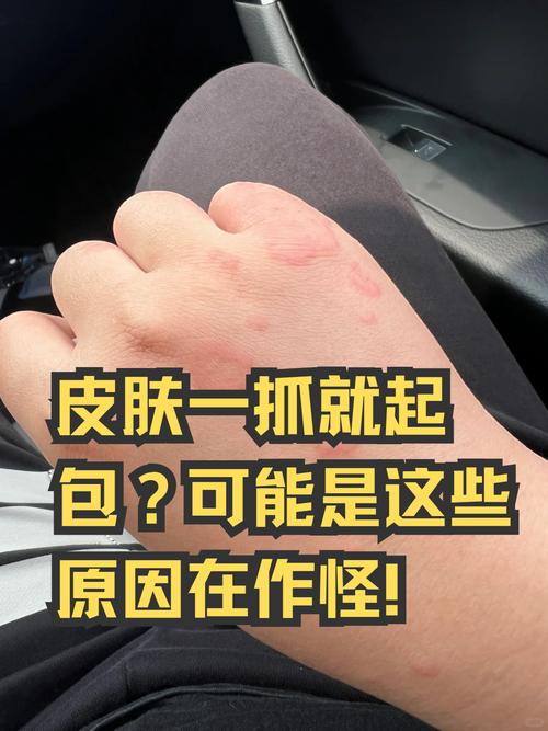 皮肤干燥起小疙瘩是过敏吗?