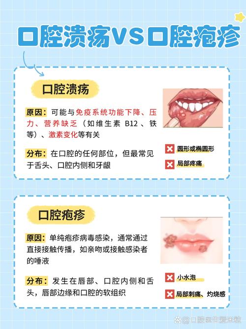 口腔疱疹不吃药能自愈吗?