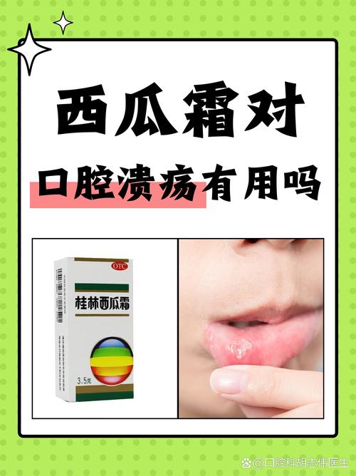 口腔疱疹不吃药能自愈吗?