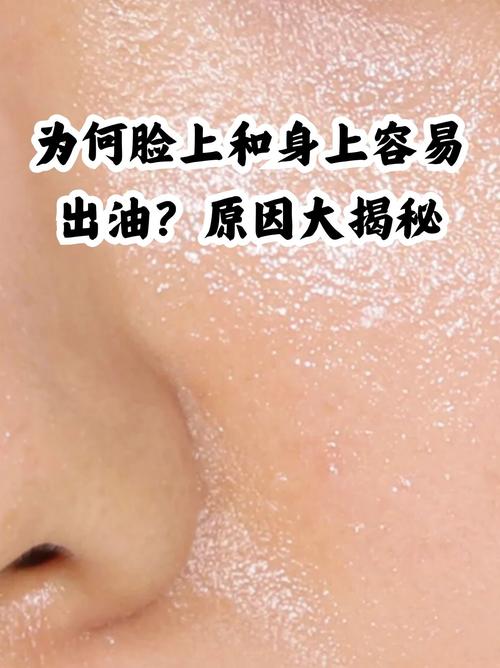 油皮如何控油不油腻?