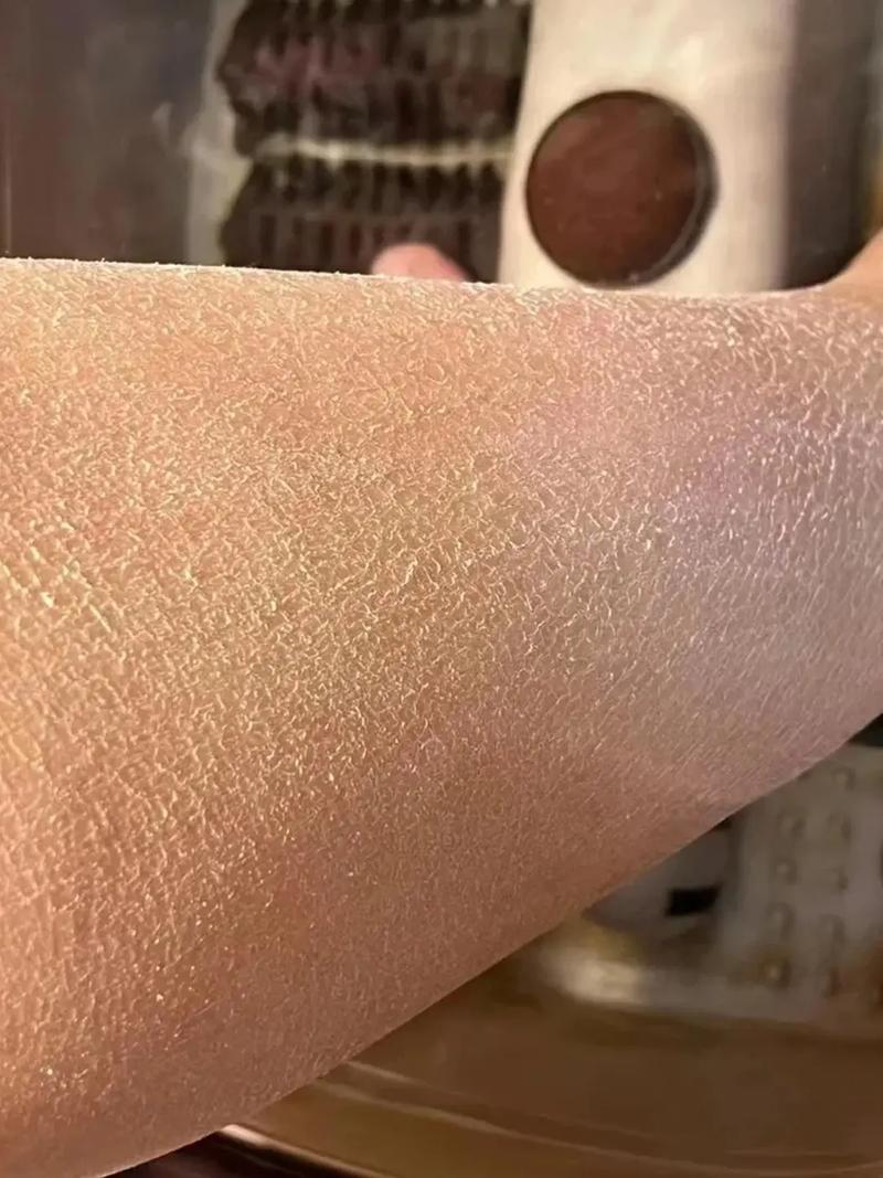 粗糙皮肤适合用什么护肤品？