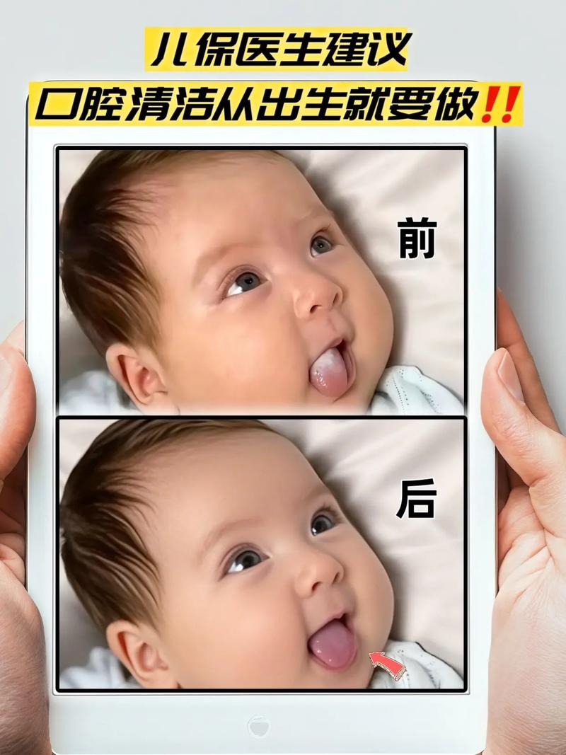 婴儿口腔护理视频教程该怎么学？