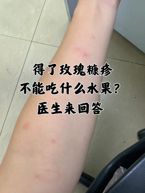 皮肤不好吃什么水果最有效?