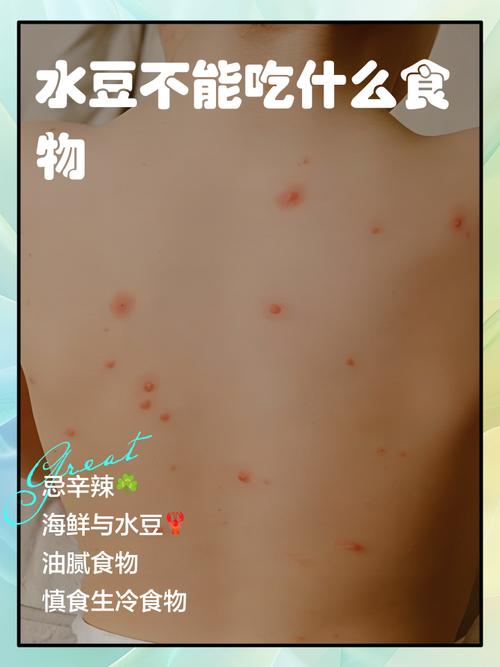 贤结水期间，哪些食物不能吃？