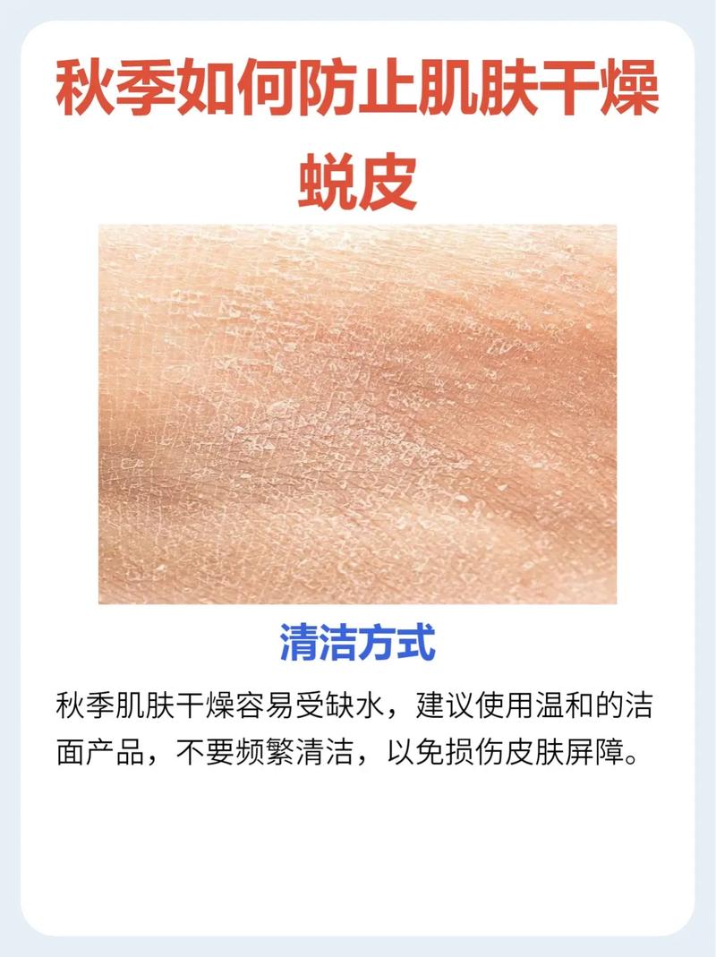 皮肤掉白色皮屑是缺水还是疾病?
