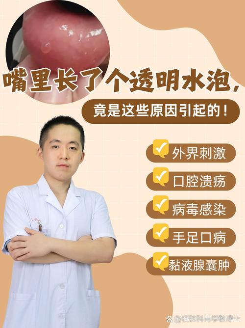 口腔起泡是上火还是身体预警?