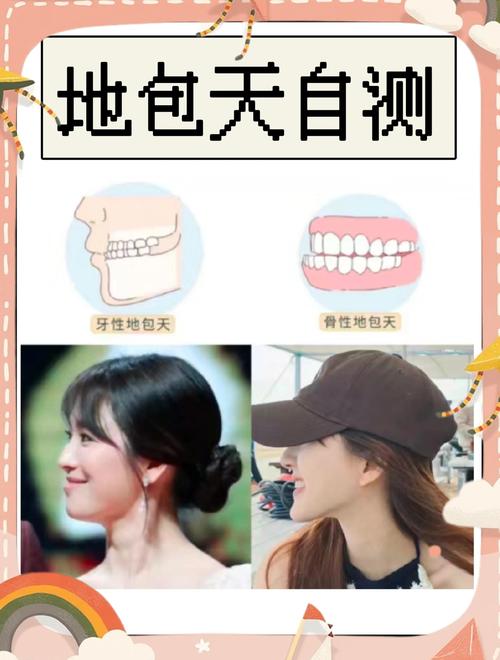 地包天该挂口腔哪个科？