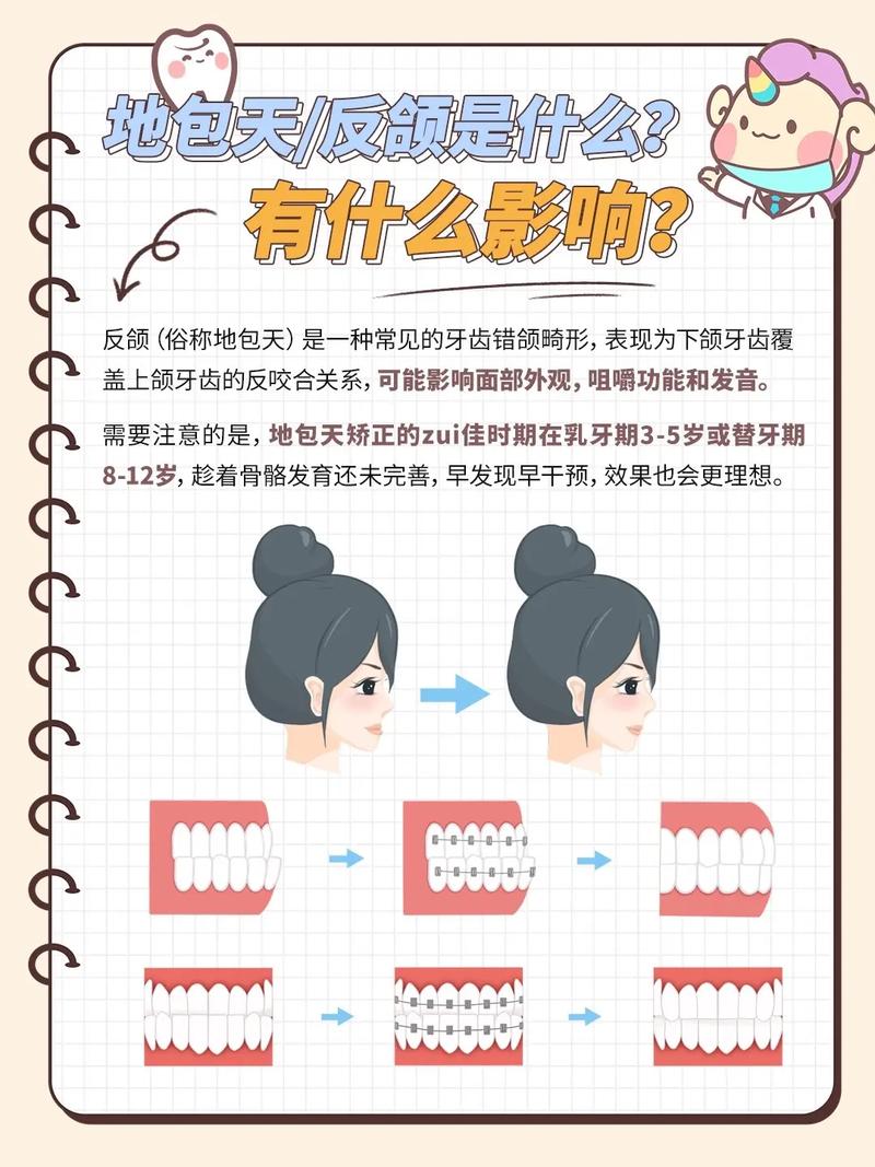 地包天该挂口腔哪个科?