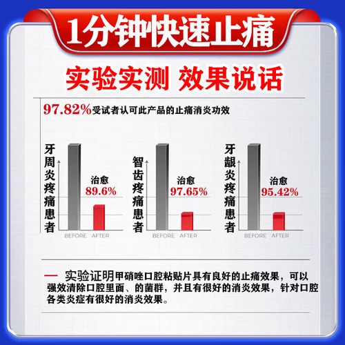 甲硝唑口腔粘贴片效果到底怎么样？