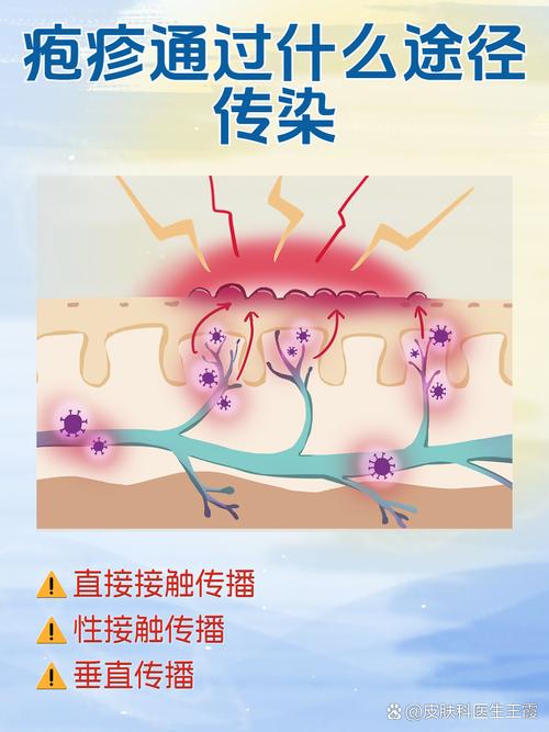 皮肤病如何传染？