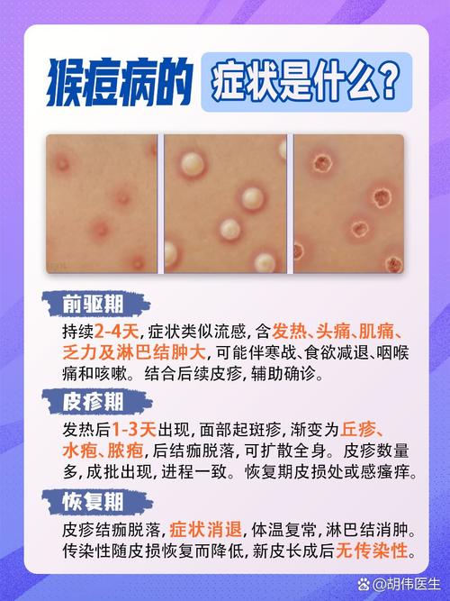 皮肤病如何传染?