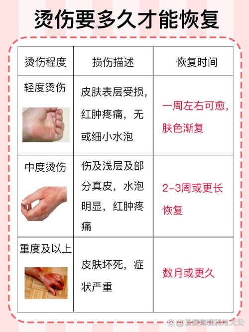 火烤伤皮肤后该如何紧急处理?