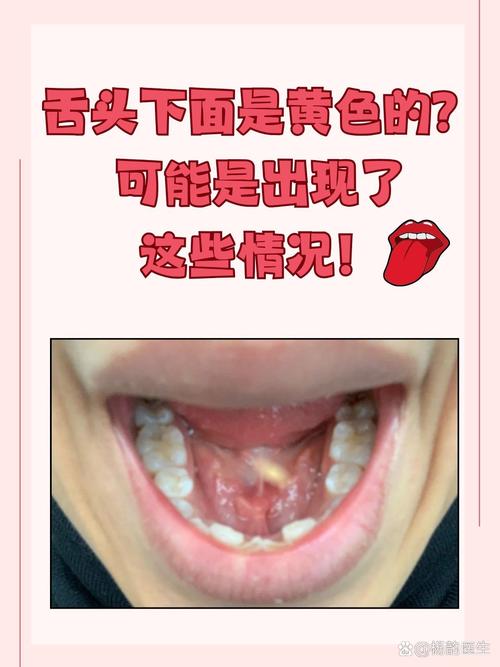 口腔发黄是何原因?