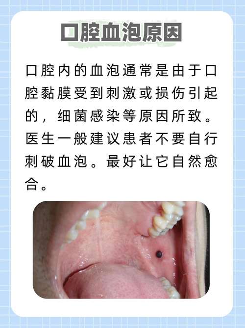 口腔出血是哪些疾病的信号?