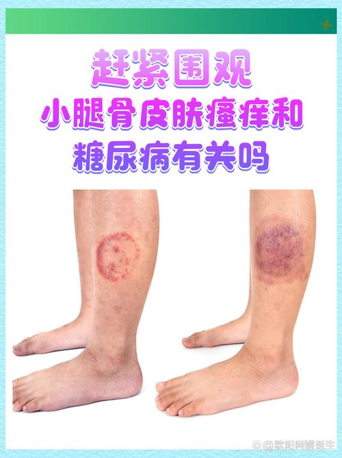 腿皮肤瘙痒是什么原因导致的？