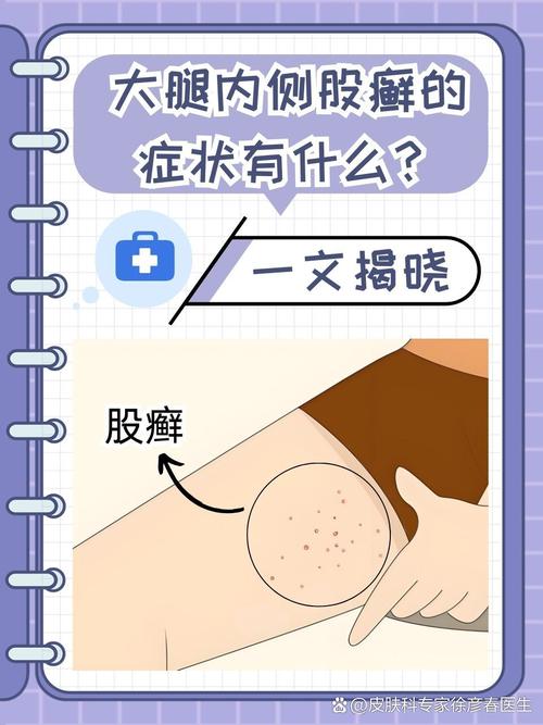 腿皮肤瘙痒是什么原因导致的?