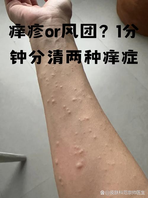 皮肤夜间发痒，是哪些疾病信号？