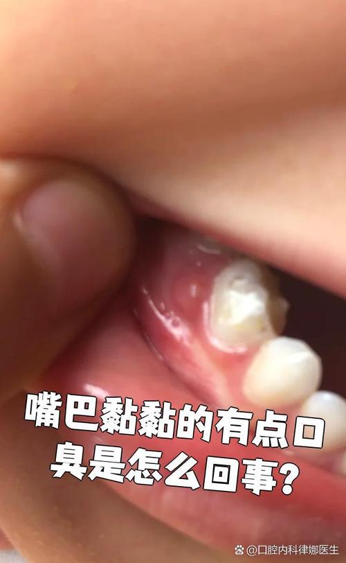 口腔黏腻、口臭是什么原因引起的？