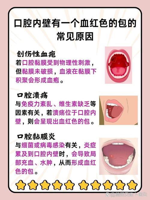 口腔易出血，是缺乏维生素还是疾病信号？