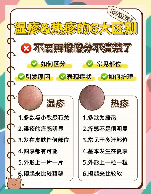 湿疹皮肤发热是炎症反应还是其他原因？