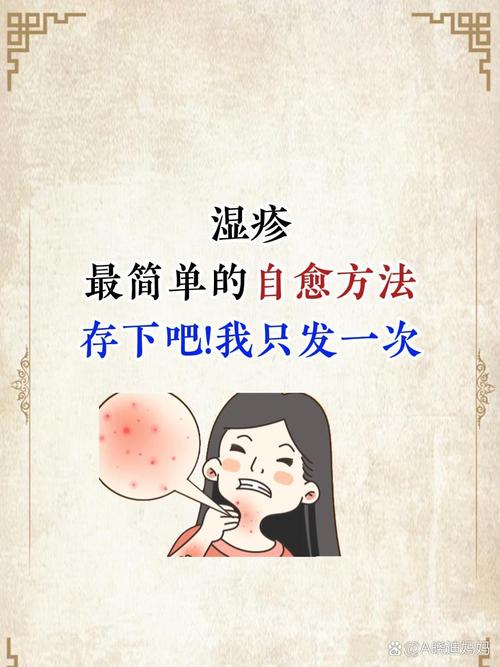 皮肤瘙痒湿疹怎么治疗？