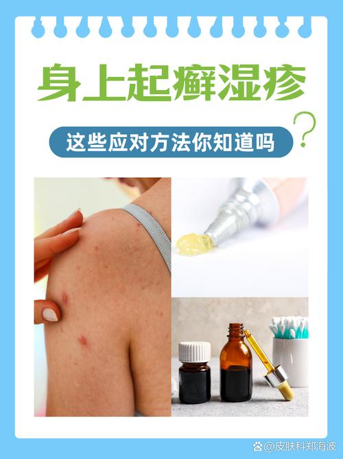 皮肤瘙痒湿疹怎么治疗?