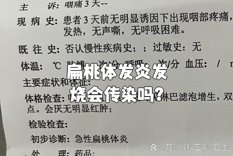 口腔发炎发烧是必然吗?