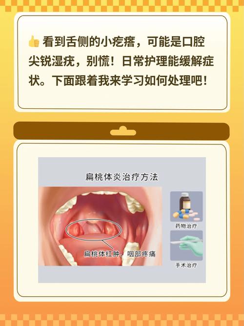 口腔尖锐该挂什么科？