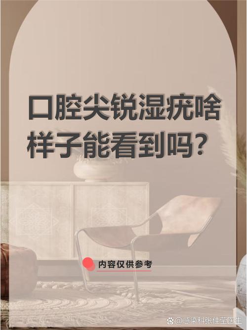 口腔尖锐该挂什么科?