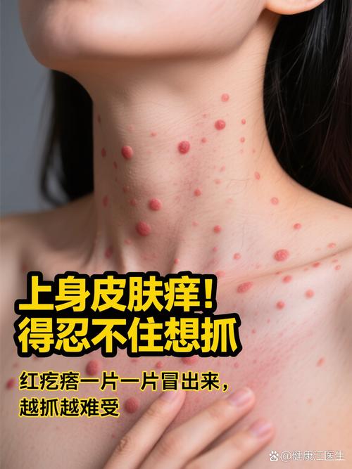 皮肤螨虫过敏图片有哪些症状表现？