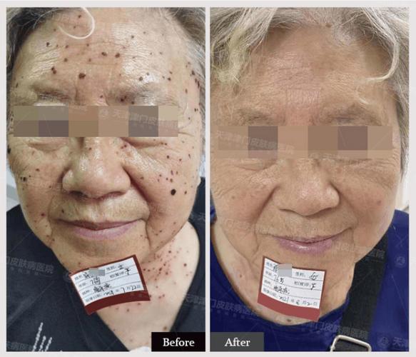 天津皮肤津门皮肤一流，为何这样说？