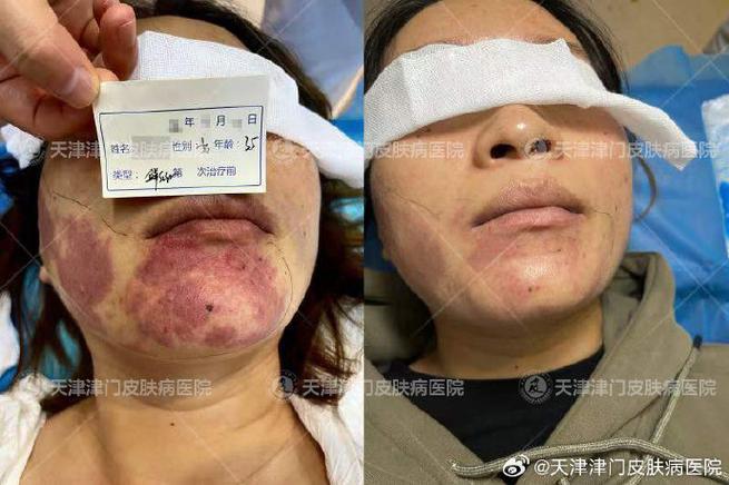 天津皮肤津门医德如何?