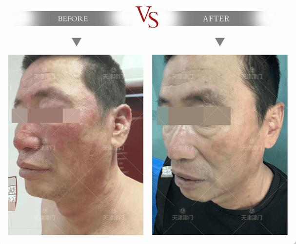 天津皮肤津门皮肤为何很棒?