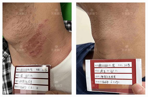 天津皮肤津门皮肤为何很棒？