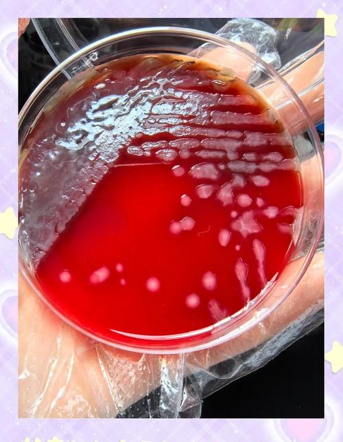 口腔铜绿假单胞菌感染有何危害与应对?