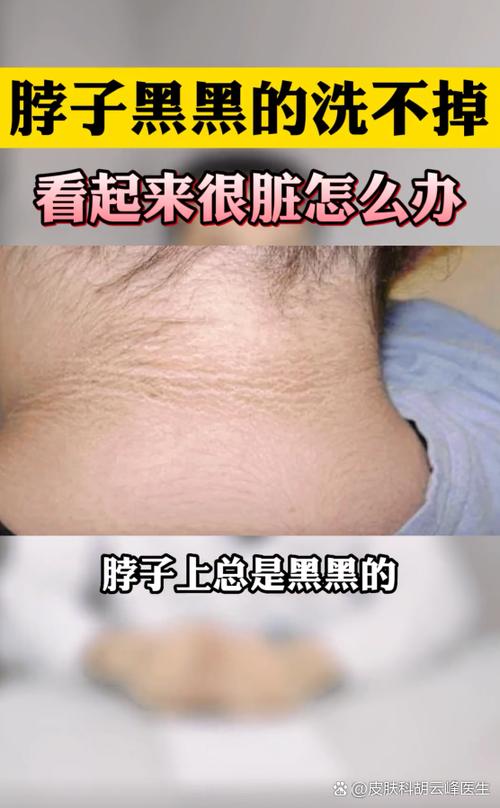 皮肤黑块发痒是何原因？