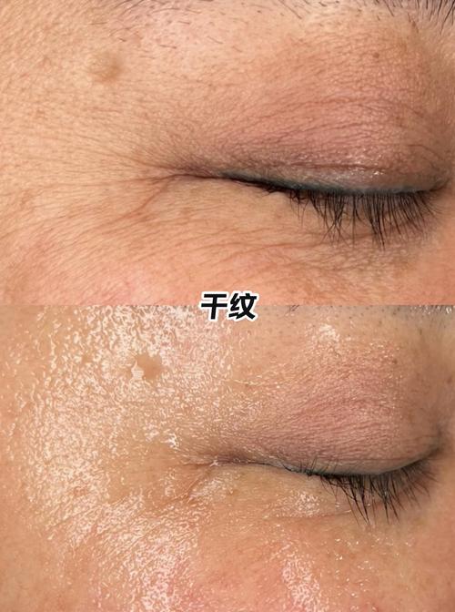 油性皮肤真比干性皮肤更抗皱吗？