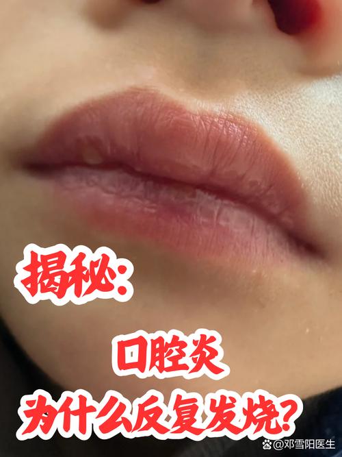 口腔疼无溃疡,是啥问题?