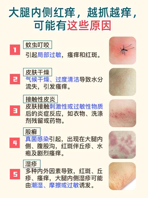 半夜皮肤痒，是啥在作祟？