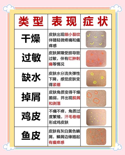 冬季皮肤干燥发痒，如何快速止痒保湿？