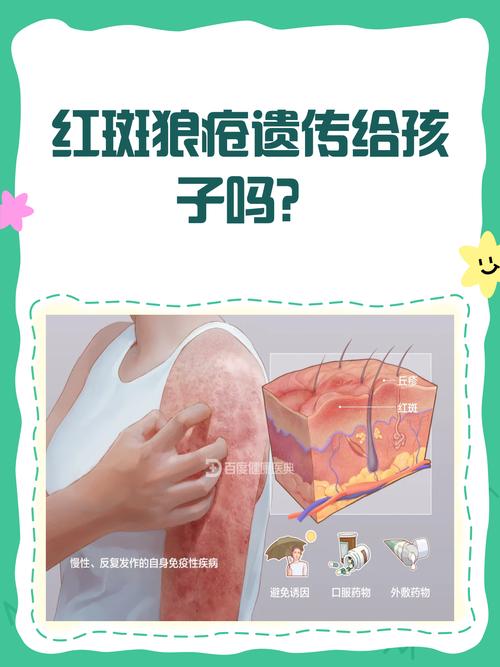 皮肤病会遗传给孩子吗？