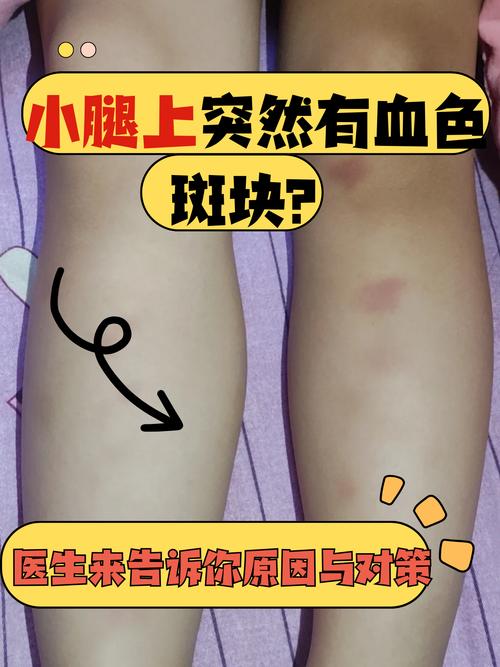 皮肤病与血液到底有无关联？