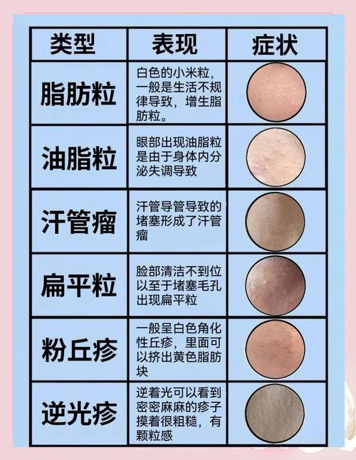脂肪粒为何总在皮肤上冒出来？