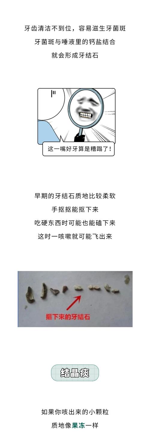 口腔吐出小黄粒是何原因？