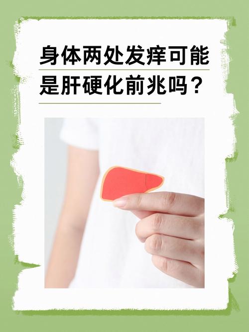 肝硬化皮肤瘙痒怎么办